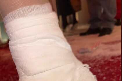 Kim Kardashian shows off her wild high-heeled cast: ‘Broken foot, but make it fashion’