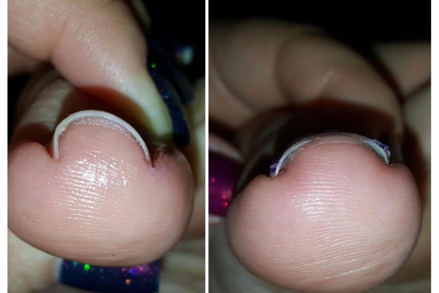 53 Practical Products With Before And After Photos So Dramatic, We Made Them Click To Reveal