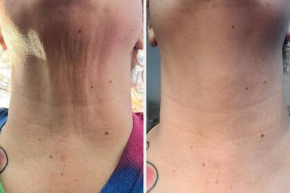When You See The Results Of These 28 Cheap Skincare Products, You’ll Be Mad At Yourself For Waiting So Long