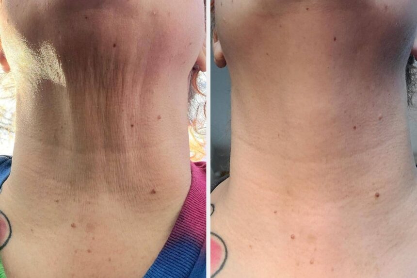 When You See The Results Of These 28 Cheap Skincare Products, You’ll Be Mad At Yourself For Waiting So Long