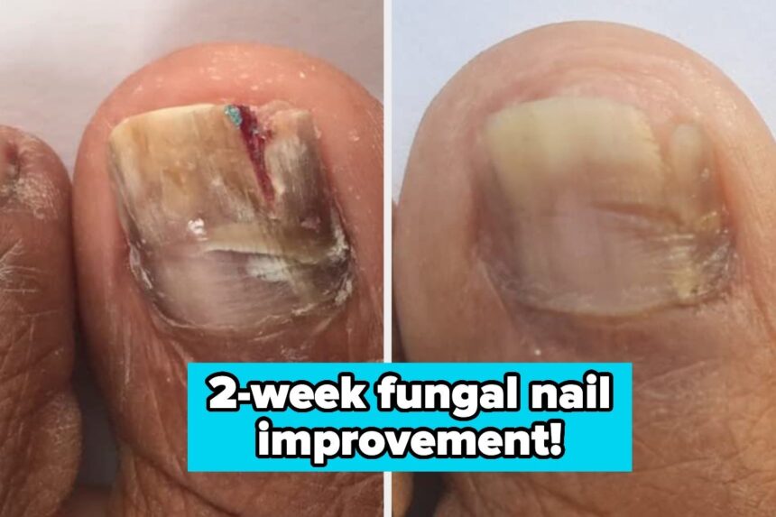 You’ll Feel Like You’ve Made A Groundbreaking Discovery After Seeing How Well These 37 Personal Care Products Work