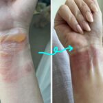 17 Personal Care Products With Before And After Photos So Gnarly, You Probably Shouldn’t Look If You’re Squeamish