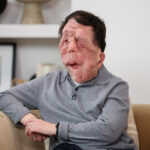 ‘A Different Man’ Star Adam Pearson to Play Joseph Merrick in ‘The Elephant Man’ Film Adaptation (EXCLUSIVE)