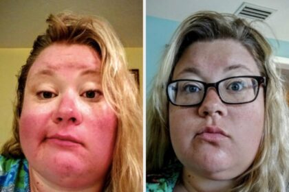 31 Personal Care Products That Begin Delivering Results “Immediately” According To Reviewers