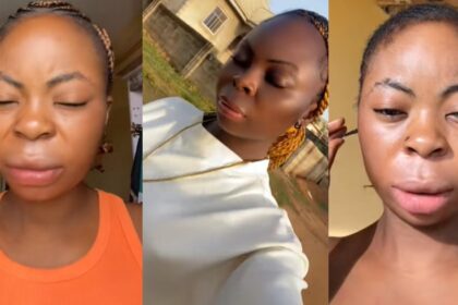 “Best decision ever” – Lady says as she shows off her skin after deciding to stop bleaching (VIDEO)