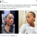 Woman Claims Skincare Treatment at Aesthetic Clinic Left Her with Permanent Scarring-gistpadi