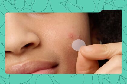 These 5 Pimple Patches are Nigerian Favourites for Their Price and Effectiveness