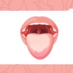 The Gross Truth About Tonsil Stones (and Why They Make Your Breath Smell)