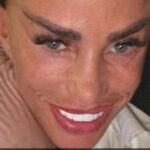 Katie Price zieht nach Facelift-OP selbst Fäden heraus