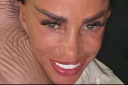 Katie Price zieht nach Facelift-OP selbst Fäden heraus
