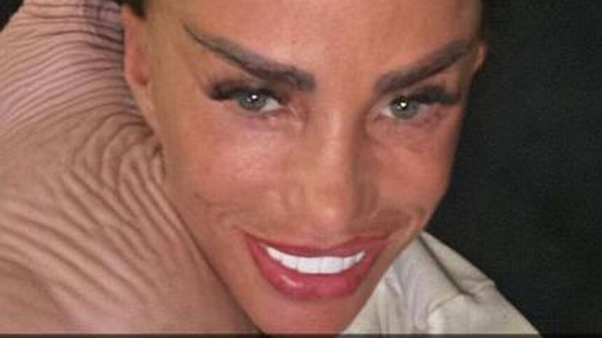 Katie Price zieht nach Facelift-OP selbst Fäden heraus